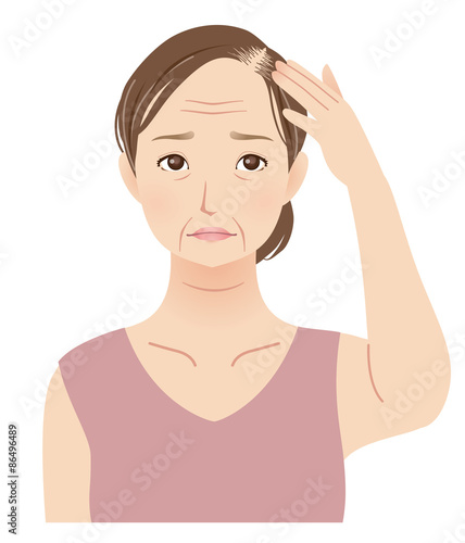 薄毛に悩む女性 中高年 Stock イラスト Adobe Stock