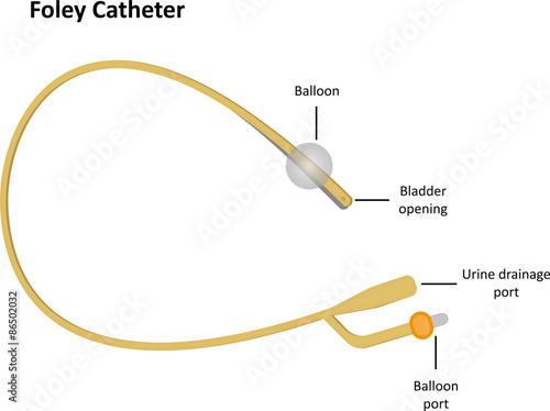 Foley Catheter Labeled photo