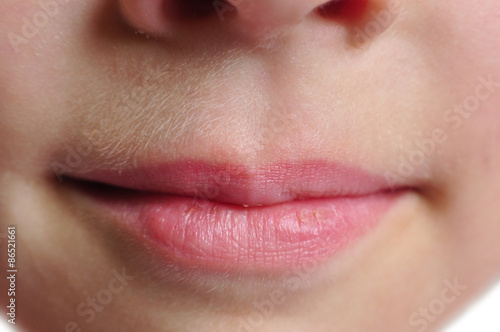 Child dry lips, mouth macro