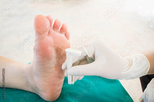 diabatic foot skining neuropathy