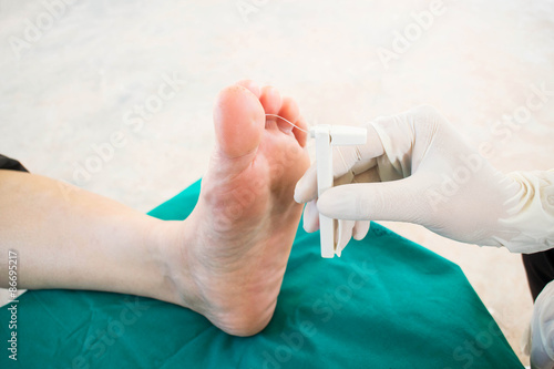 diabatic foot skining neuropathy photo