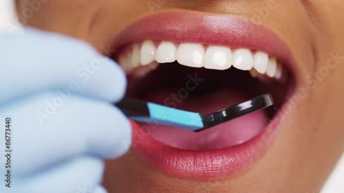 Close up of smiling black woman at dentist