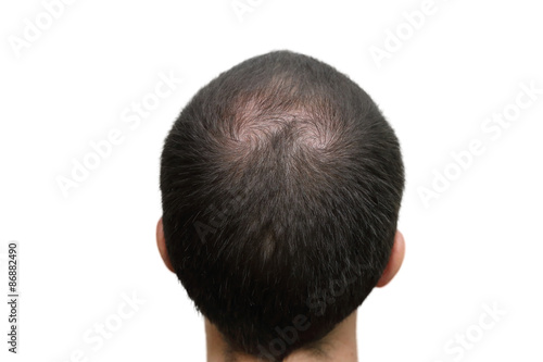 background of bald head