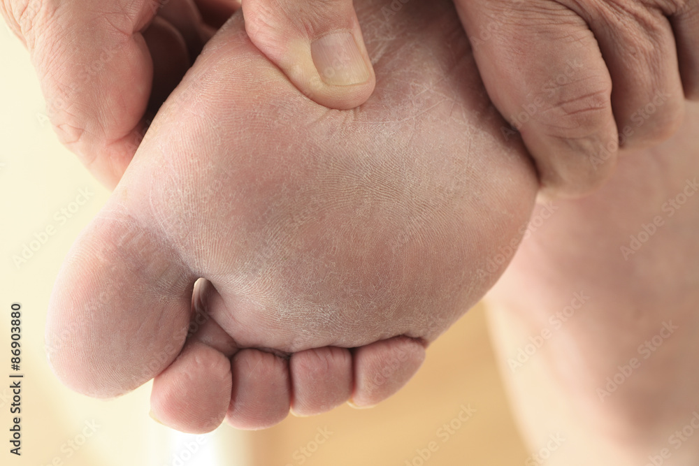 Man with hand on foot Man with hand on foot