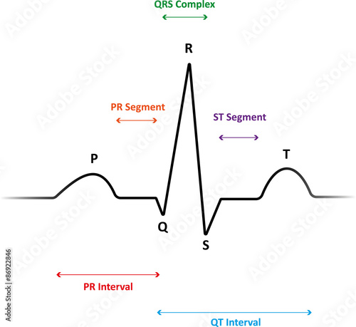 ECG Waveform