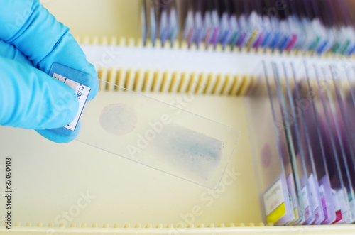 Fotografie Blood film for blood cell and malaria morphology