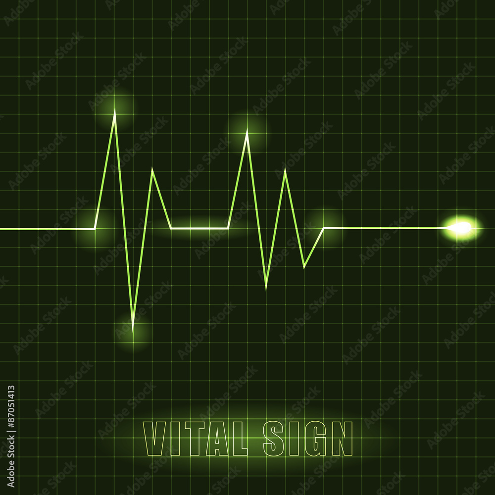 Heart cardiogram vector illustration Heart cardiogram vector illustration