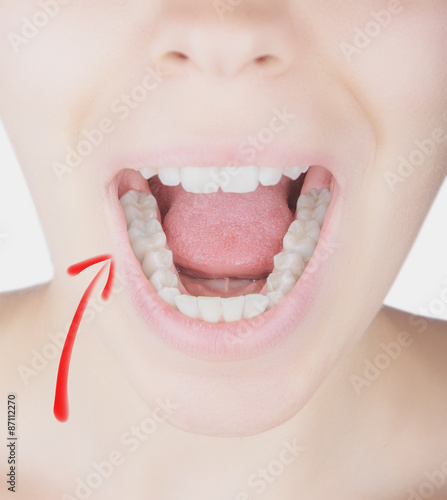 Denti bocca donna 