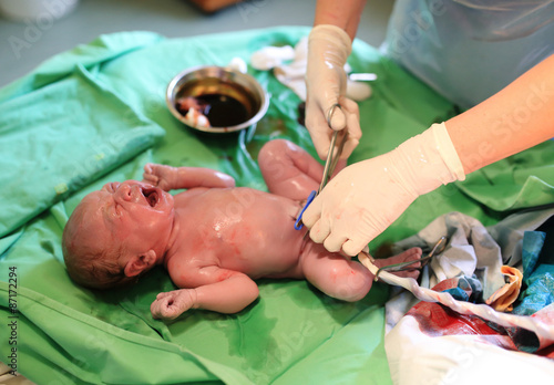 фотографія Newborn baby after birth in hospital