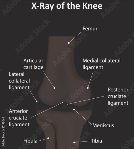 X-Ray of the Knee