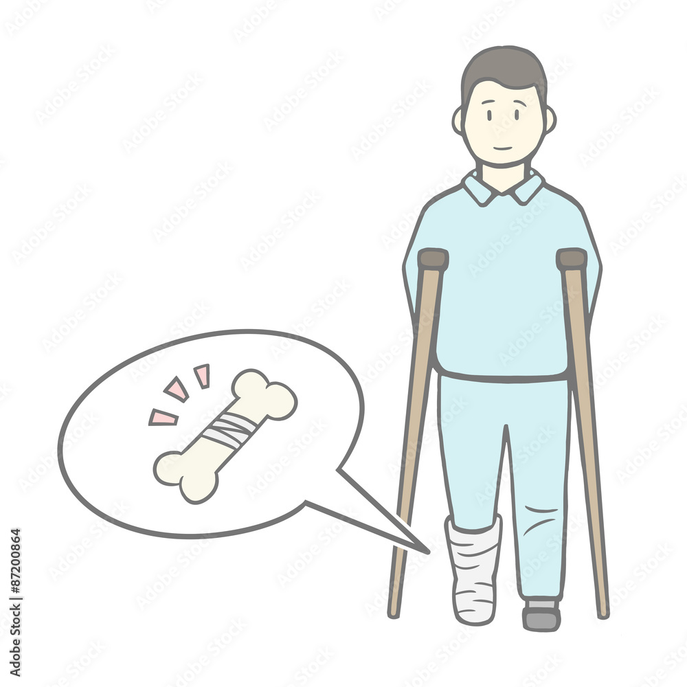 骨折 骨折
