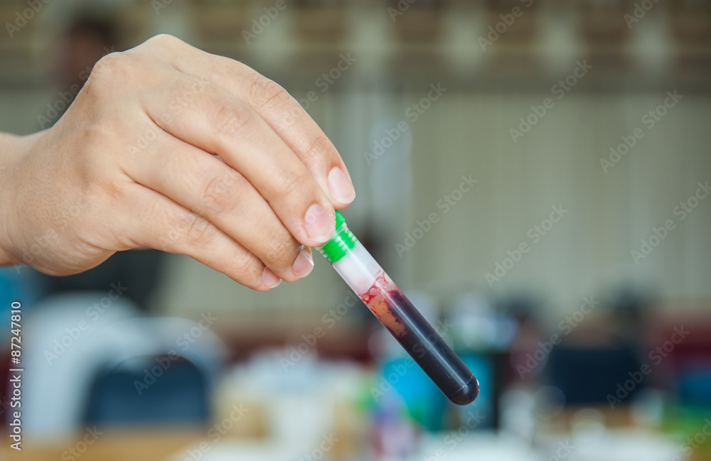 Blood samples for the annual health check. Blood samples for the annual health check.