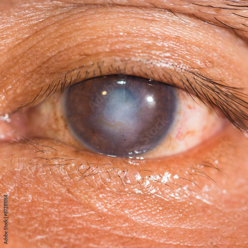 Tablou pe pânză eye exam