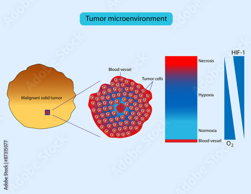 Hypoxia in tumors