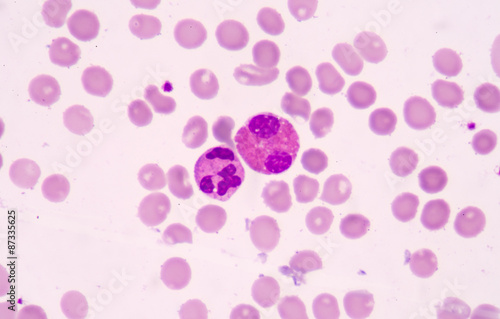 White blood cells of a human, photomicrograph panorama as seen u