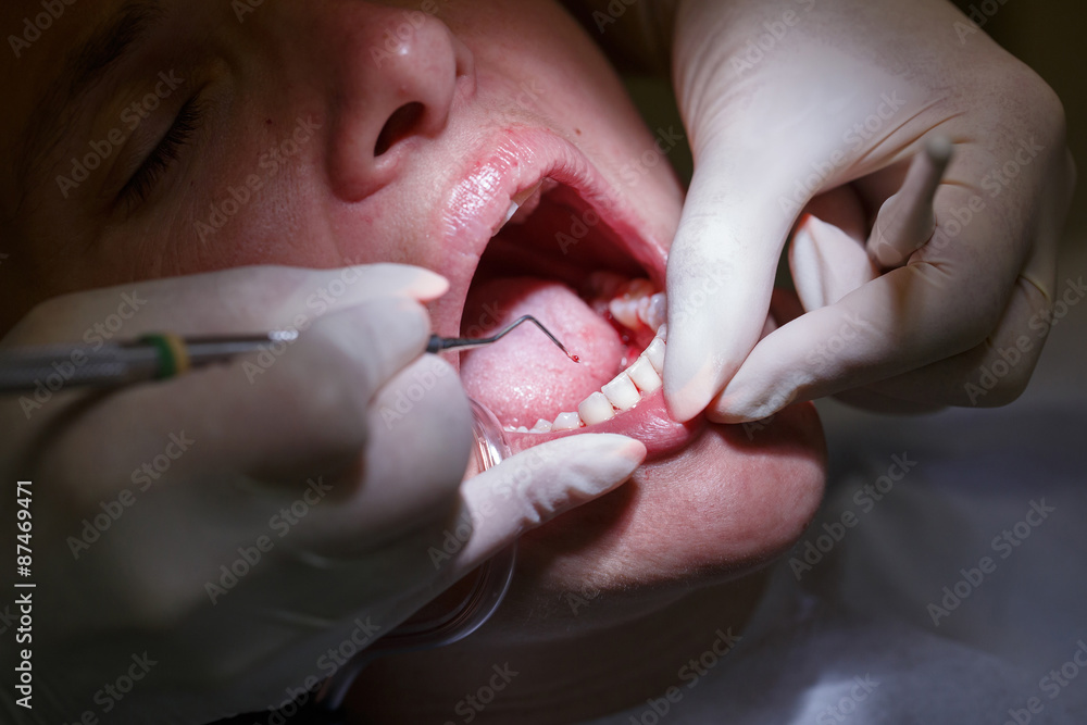 Woman at dentists office