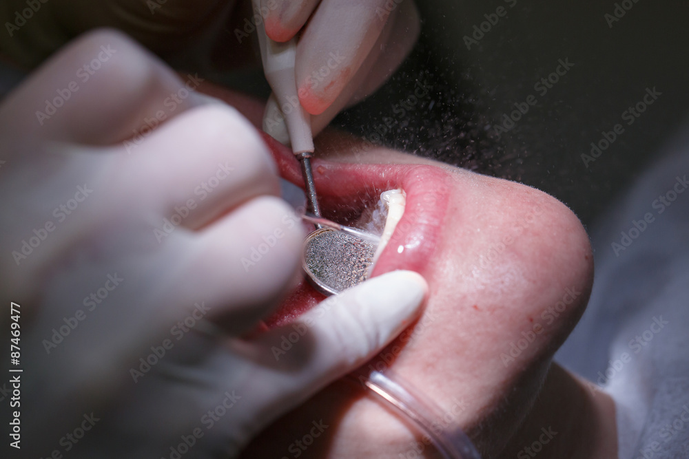 Fototapeta premium Patient at dentists office