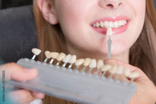Beim Zahnarzt - Zahnfarbe für eine Krone vergleichen