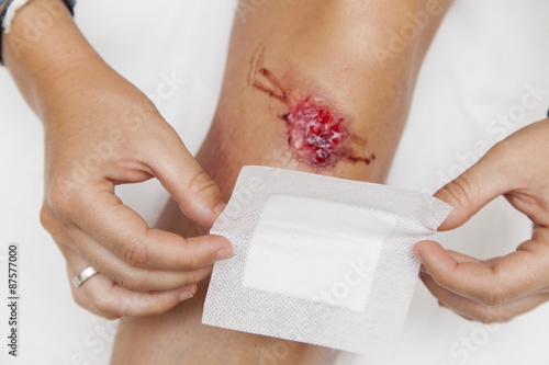 Person with fresh bleeding wounds on the knees The damage is treated with an adhesive bandage, to prevent the blood from flowing. Against white background, closeup,