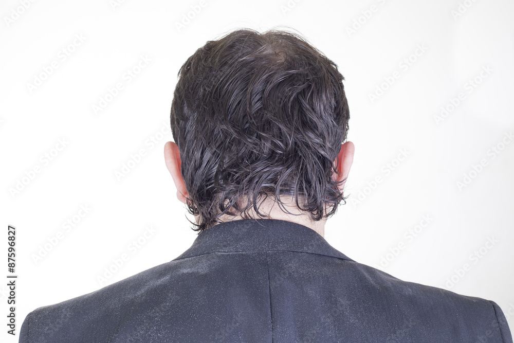 Hombre con caspa Hombre con caspa