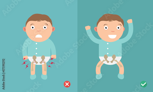 Best and worst positions child for prevention of hip dysplasia photo