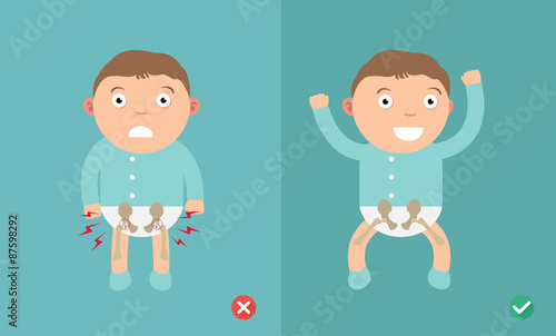 Best and worst positions child for prevention of hip dysplasia