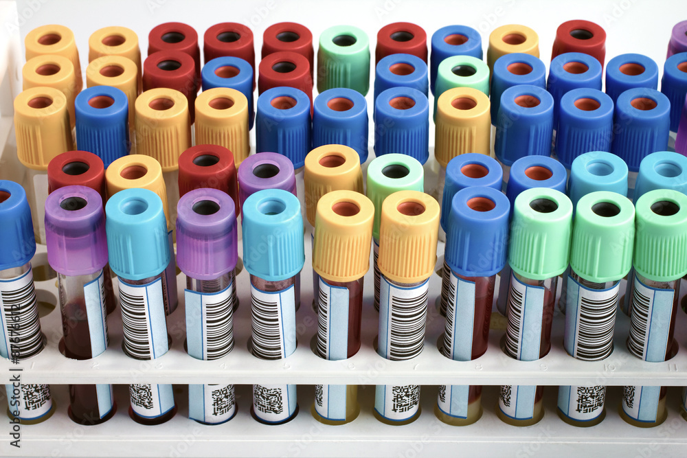 rack of blood tubes labeled in blood bank lab / Tubes with bar code for