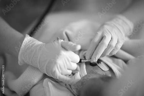 Listening heart sounds of a newborn  doctor applying a stethoscope to a baby s chest