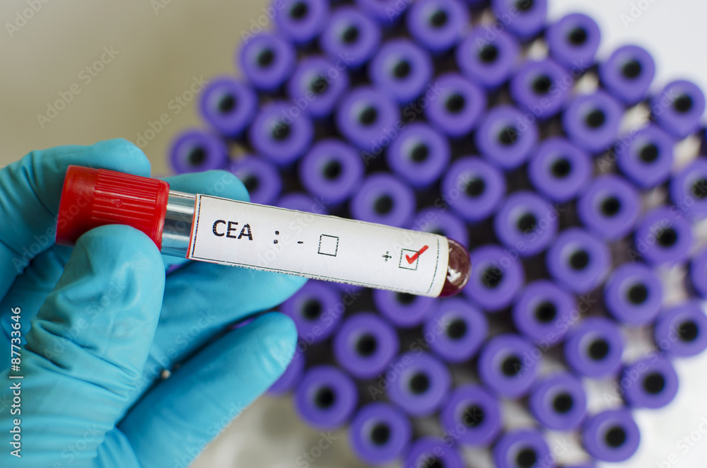 Obraz premium CEA positive