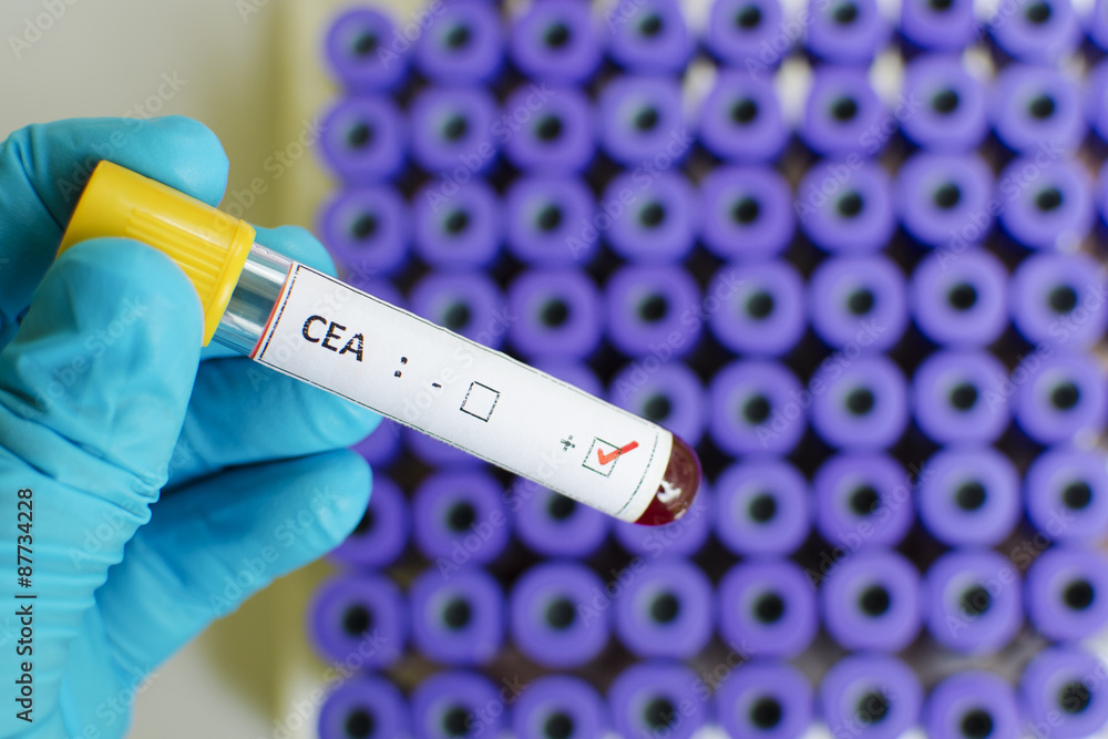 Obraz premium CEA positive