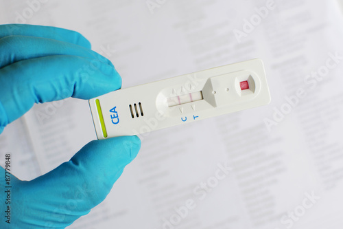 CEA (Carcinoembryonic antigen) positive photo