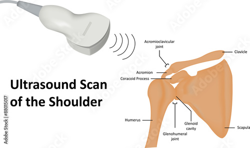 Ultrasound Scan of Shoulder