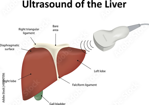 Ultrasound of the Liver