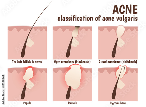 structure of the hair follicle