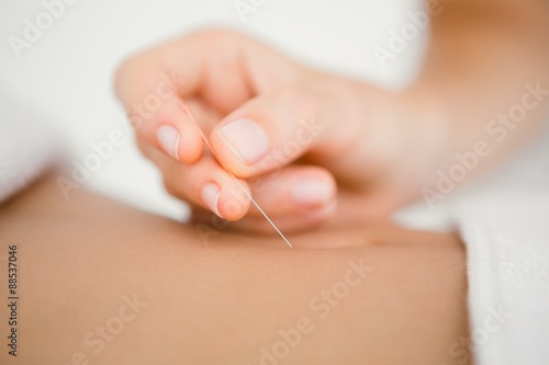 Woman holding a needle in an acupuncture therapy photo