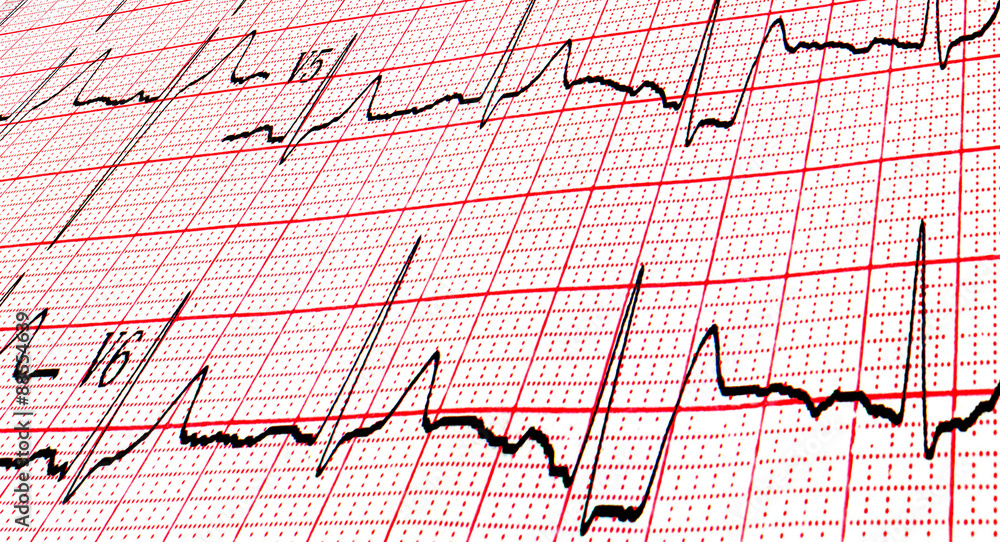 Cardiogram by CU Cardiogram by CU