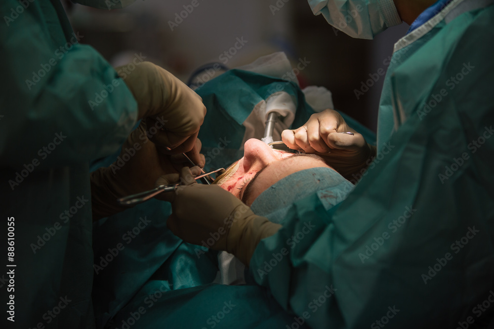 Plastic surgery of male installation of implants in the chin Plastic surgery of male installation of implants in the chin