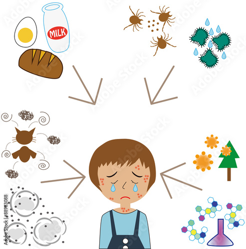 アレルギー要因と女の子