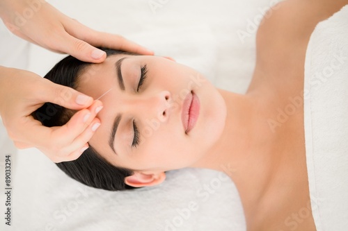 Woman in an acupuncture therapy photo