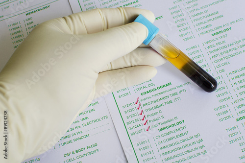 Canvas Print Blood sample for coagulation testing