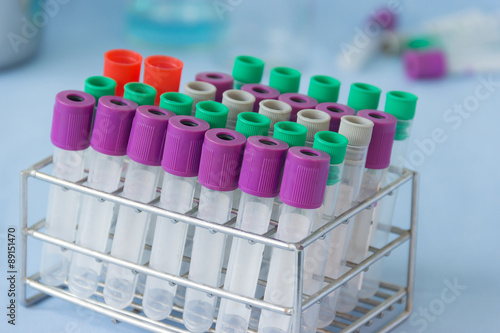 Test tube blood specimen