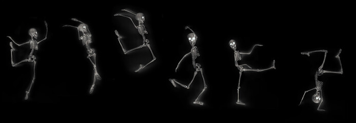 Dancing Skeleton X-Ray
