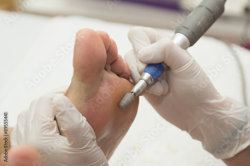 Fotografie Pedicura