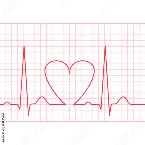 ECG - electrocardiogram feed
