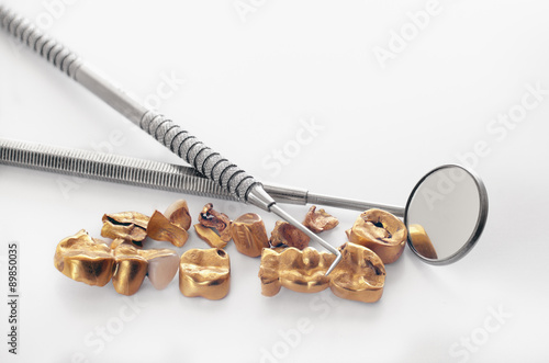 Removed from teeth old golden dental bridge