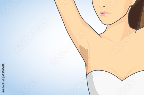 Woman showing her armpit skin discoloration with the lifting up arm. 
