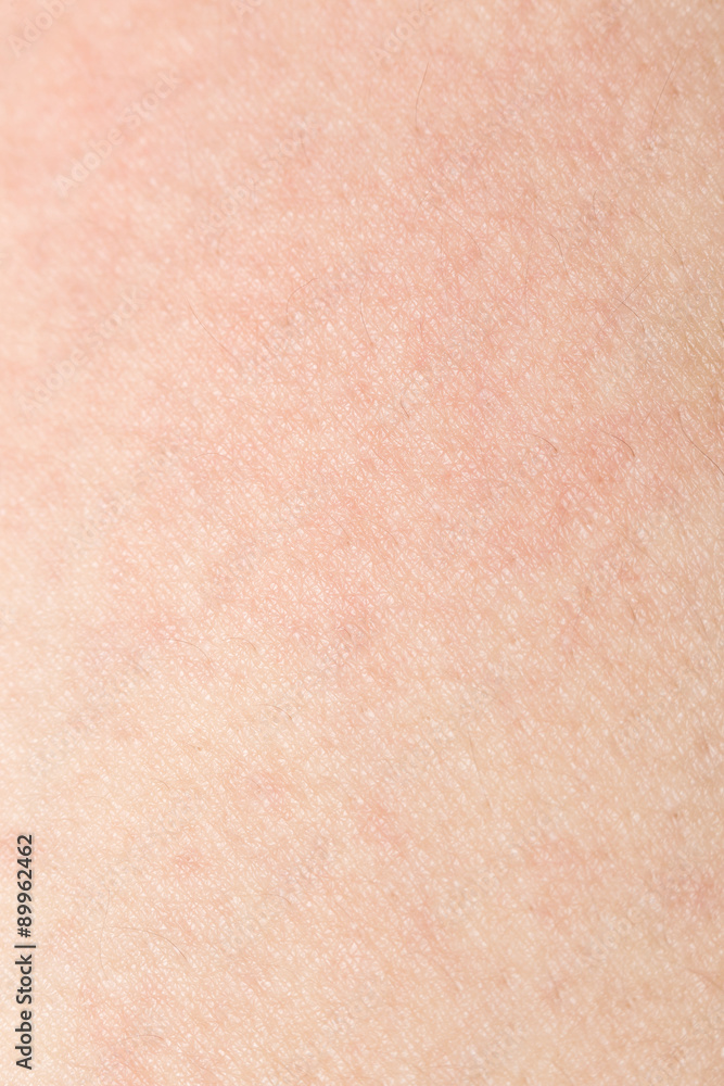 Human skin texture with black hairs on the skin for healthy back Human skin texture with black hairs on the skin for healthy back