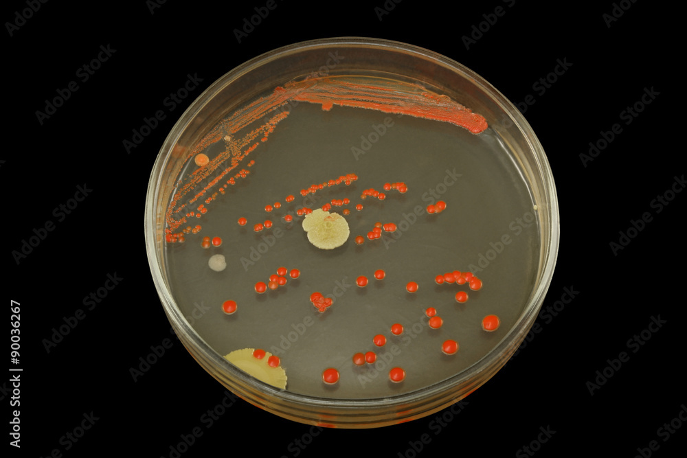 Colonies of oiloxydizing bacteria of redorange color on a petri plate