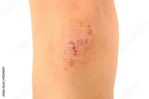 Woman nursing a injured knee isolated on white background