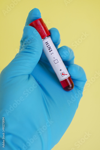 H1N1 Influenza positive photo